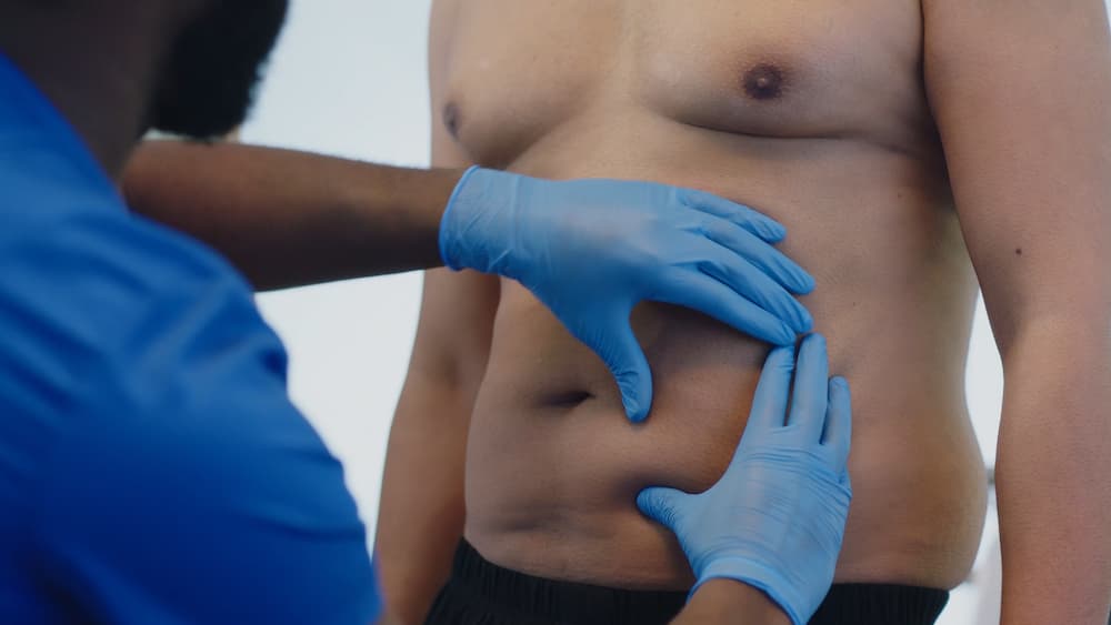 CoolSculpting