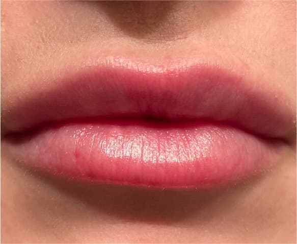 Lip Plump After