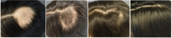 Before and after